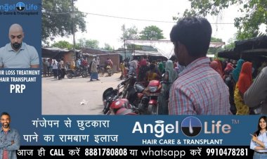 प्रयागराज : शर्प दंश से पिता-पुत्र की मौत