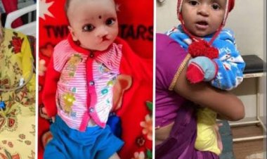 योगी सरकार श्रवण बाधित बच्चों का निशुल्क करा रही आपरेशन, मांगा आवेदन 