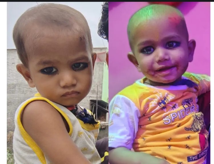 कफ सीरप पीने से दो मासूम भाइयों की बिगड़ी तबीयत, एक की मौत, दूसरा सैफई रेफर