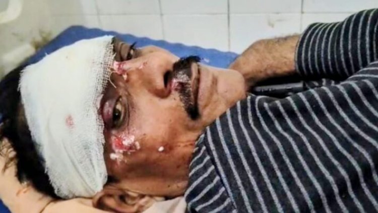 पत्रकार को बाइक से कुचलने की कोशिश, पुलिस जांच में जुटी