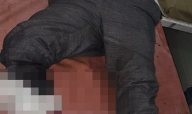 पुलिस मुठभेड़ में घायल बदमाश समेत गिरफ्तार