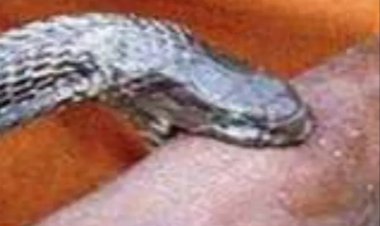 सब्जी काटने गई महिला को सांप ने डसा, इलाज के दौरान मौत