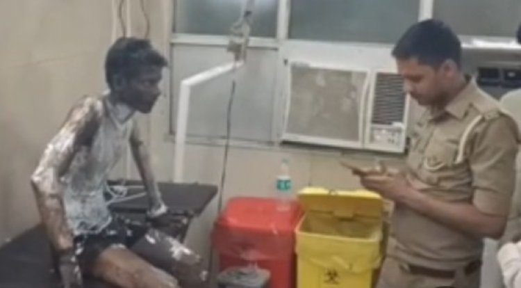 प्रेम प्रसंग के आरोप में युवक पर पेट्रोल डालकर जिन्दा जलाने का प्रयास