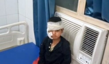 सियार ने दो बच्चों पर हमला किया,घायल