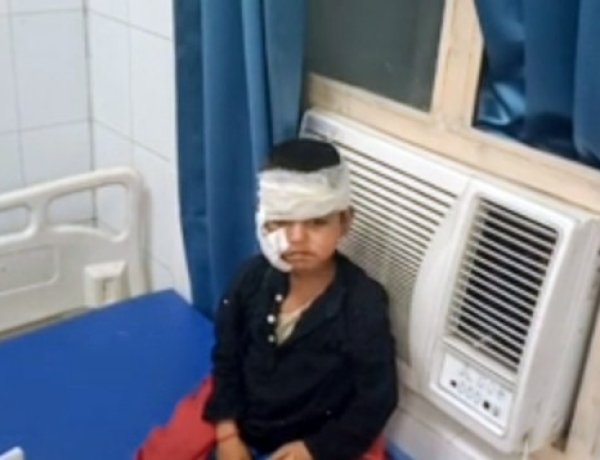 सियार ने दो बच्चों पर हमला किया,घायल