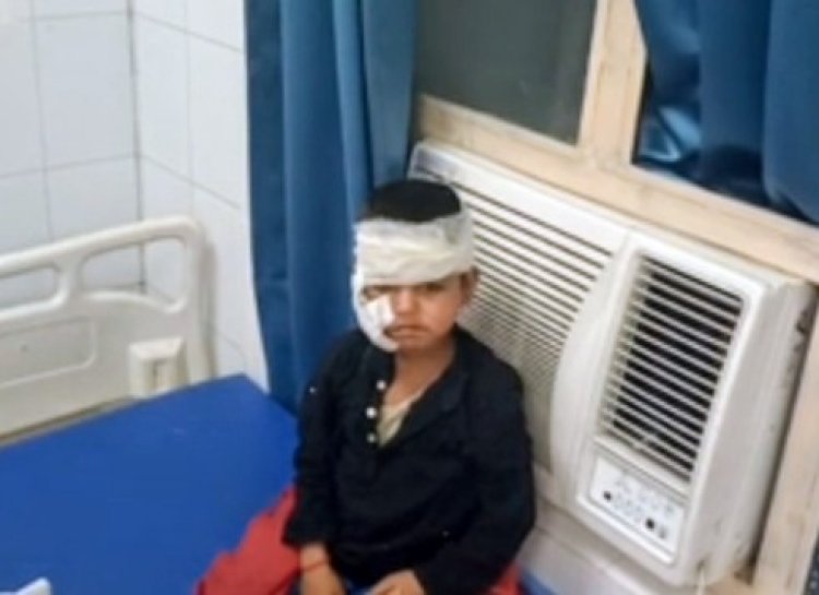 सियार ने दो बच्चों पर हमला किया,घायल