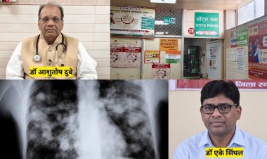 टीबी समझकर शुरू कर दी दवा, जांच में निकली दूसरी बीमारी